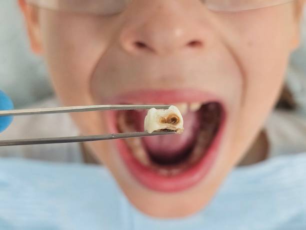 Best Emergency Dental Surgery in Porters Neck, NC